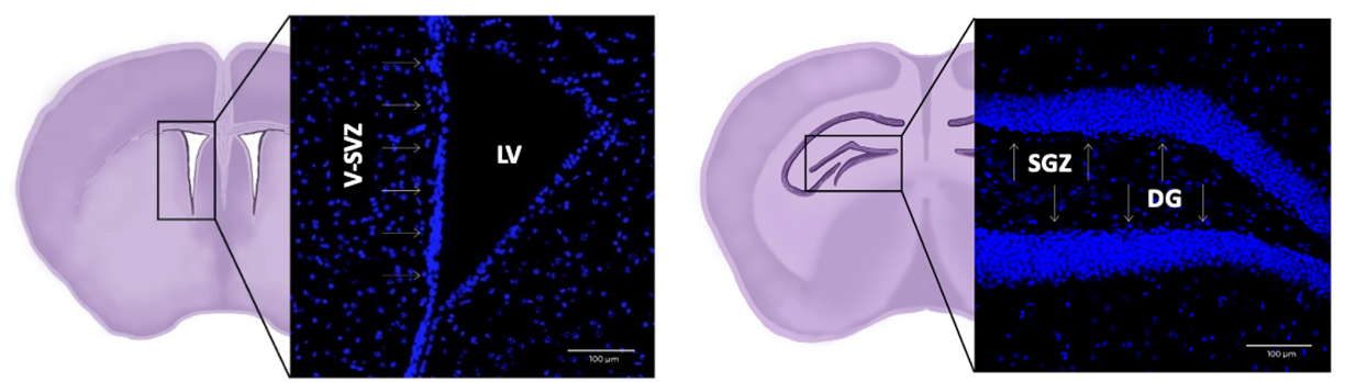 Highlighted Project Image
